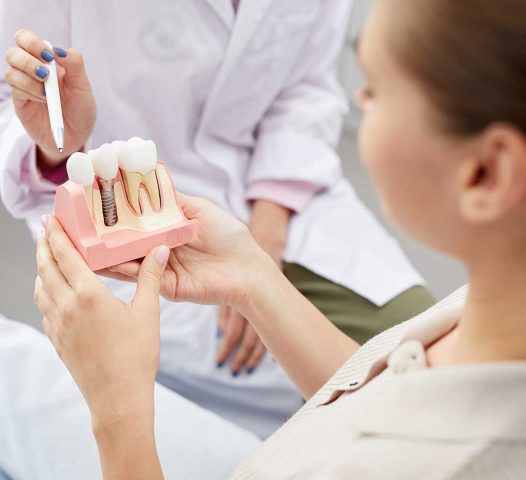 Uzupełnianie ubytków zębów za pomocą implantów