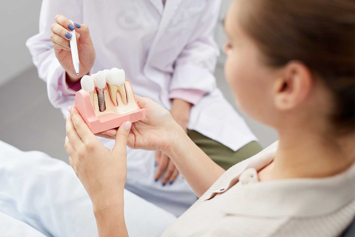 Uzupełnianie ubytków zębów za pomocą implantów
